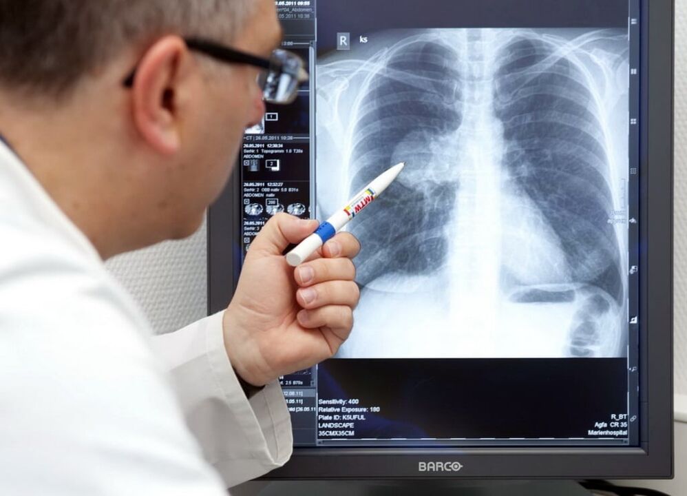 Diagnose einer arteriellen Hypertonie